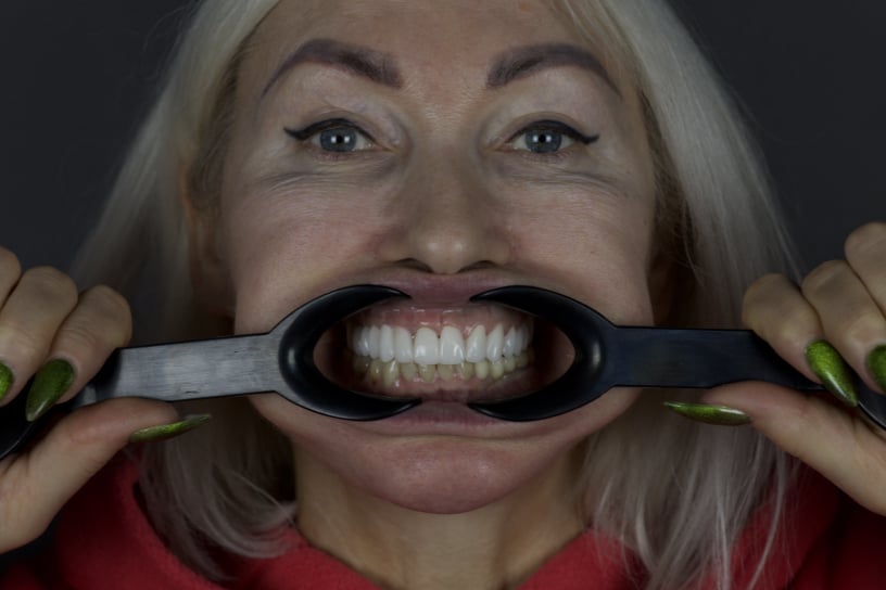 Реставрация на балке: Зубные протезы на заказ Алматы с фрезеровкой циркония в цифровой лаборатории.