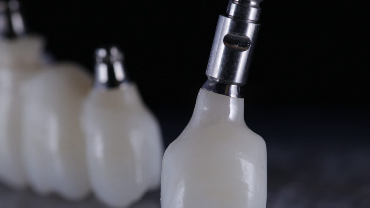 Циркониевая коронка на импланте: Импланты с коронкой Алматы для прочного протезирования зубов.